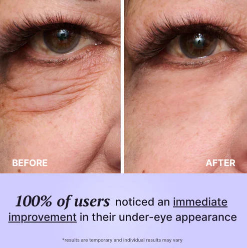 Instant Eye Tightener