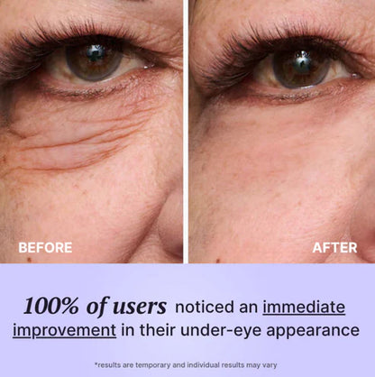 Instant Eye Tightener